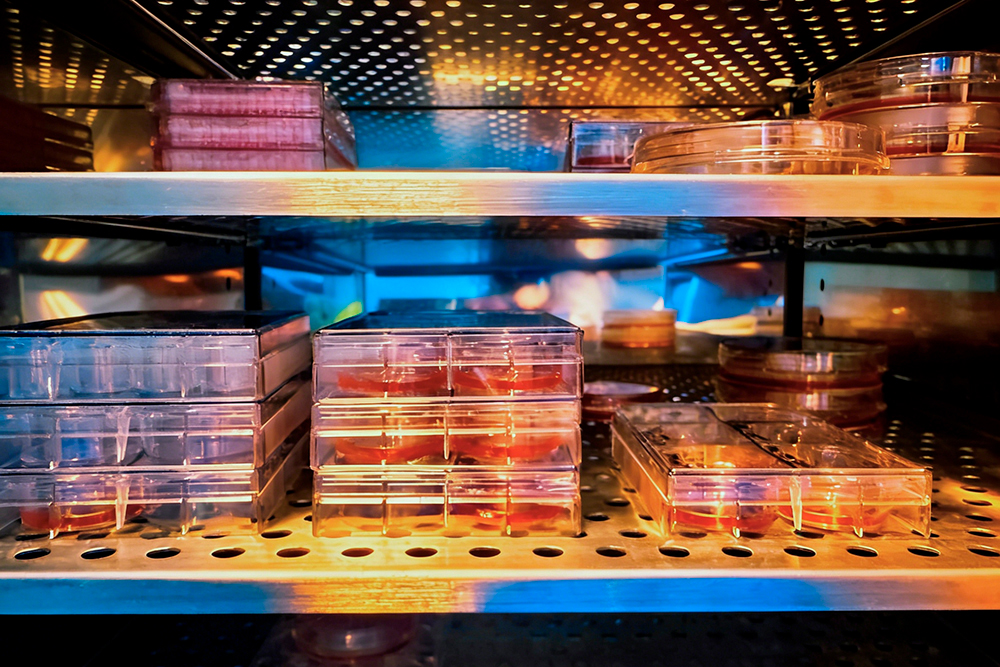 patient's fibroblasts in the incubator